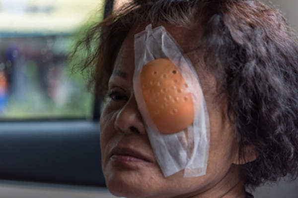 眼部手术后出院