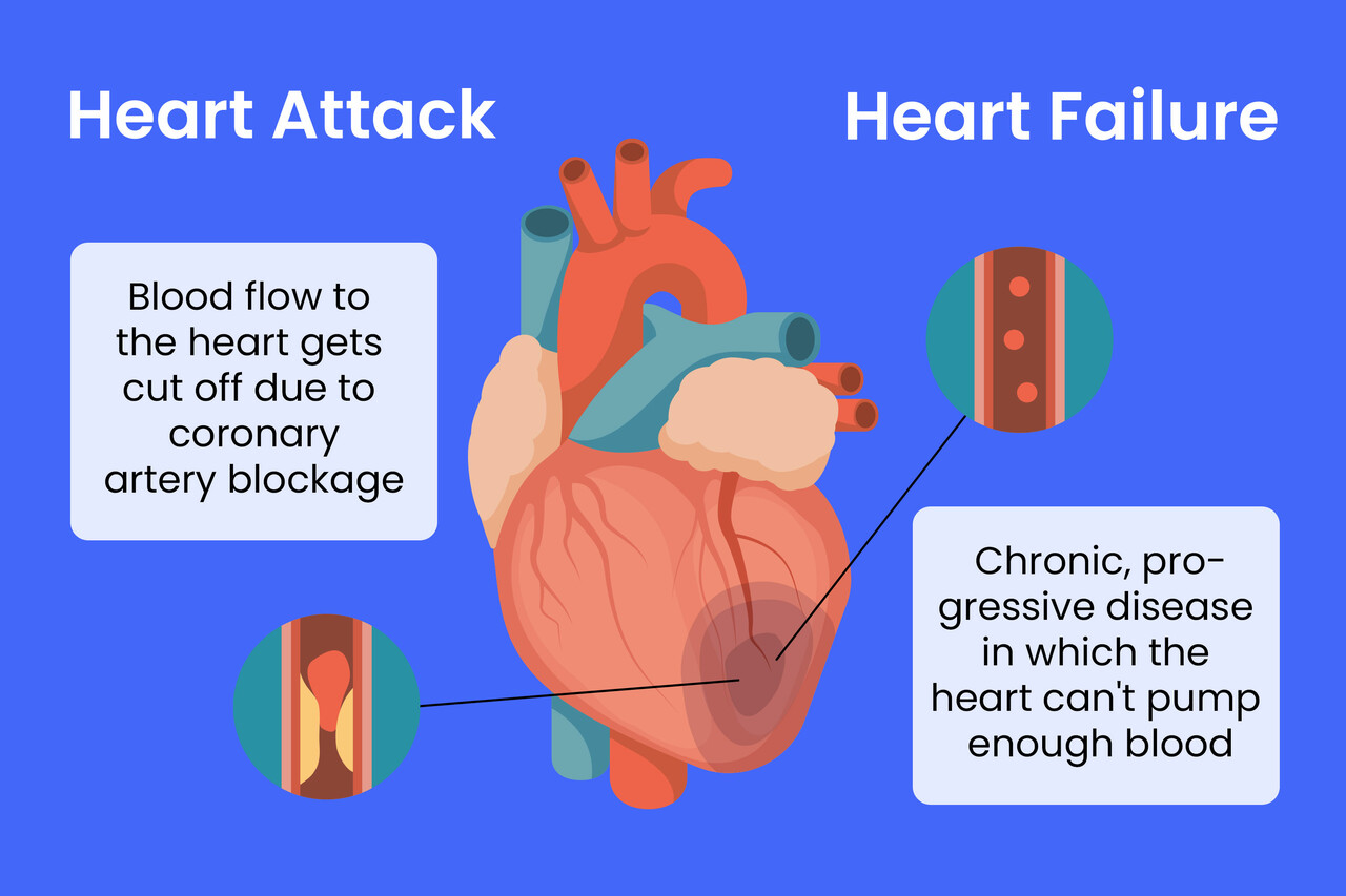 Heart Attack Vs. Heart Failure: What’s The Difference?