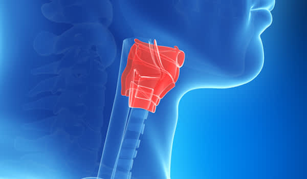 胃酸反流严重影响喉的图像。