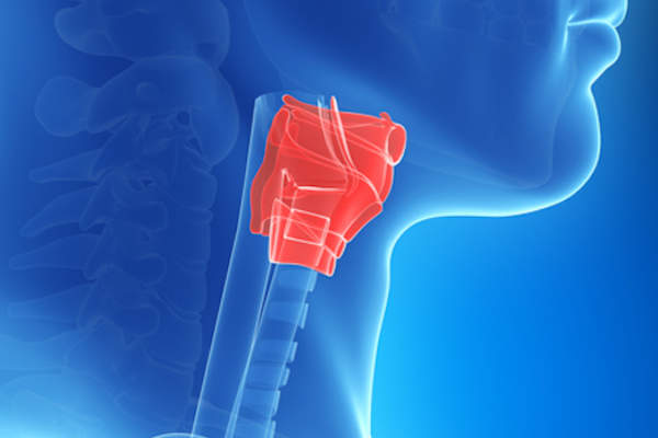 胃酸反流严重影响喉的图像。