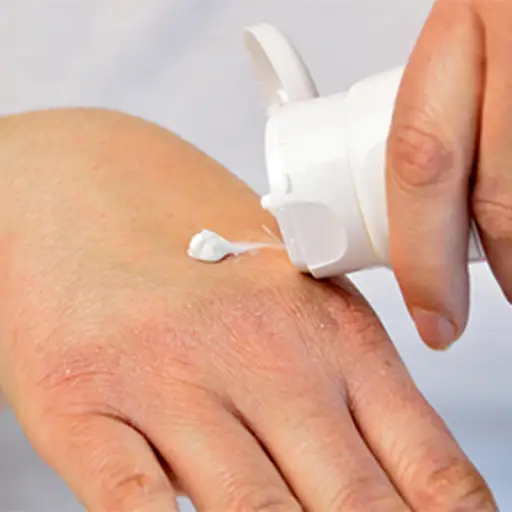 9 Warning Signs Of An Eczema Flare 9 Warning Signs Of An Eczema Flare