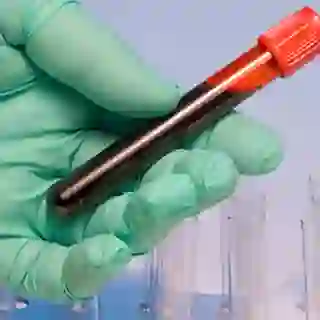 blood vial image