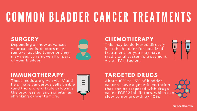 Bladder Cancer Symptoms, Causes, Diagnosis and Treatment