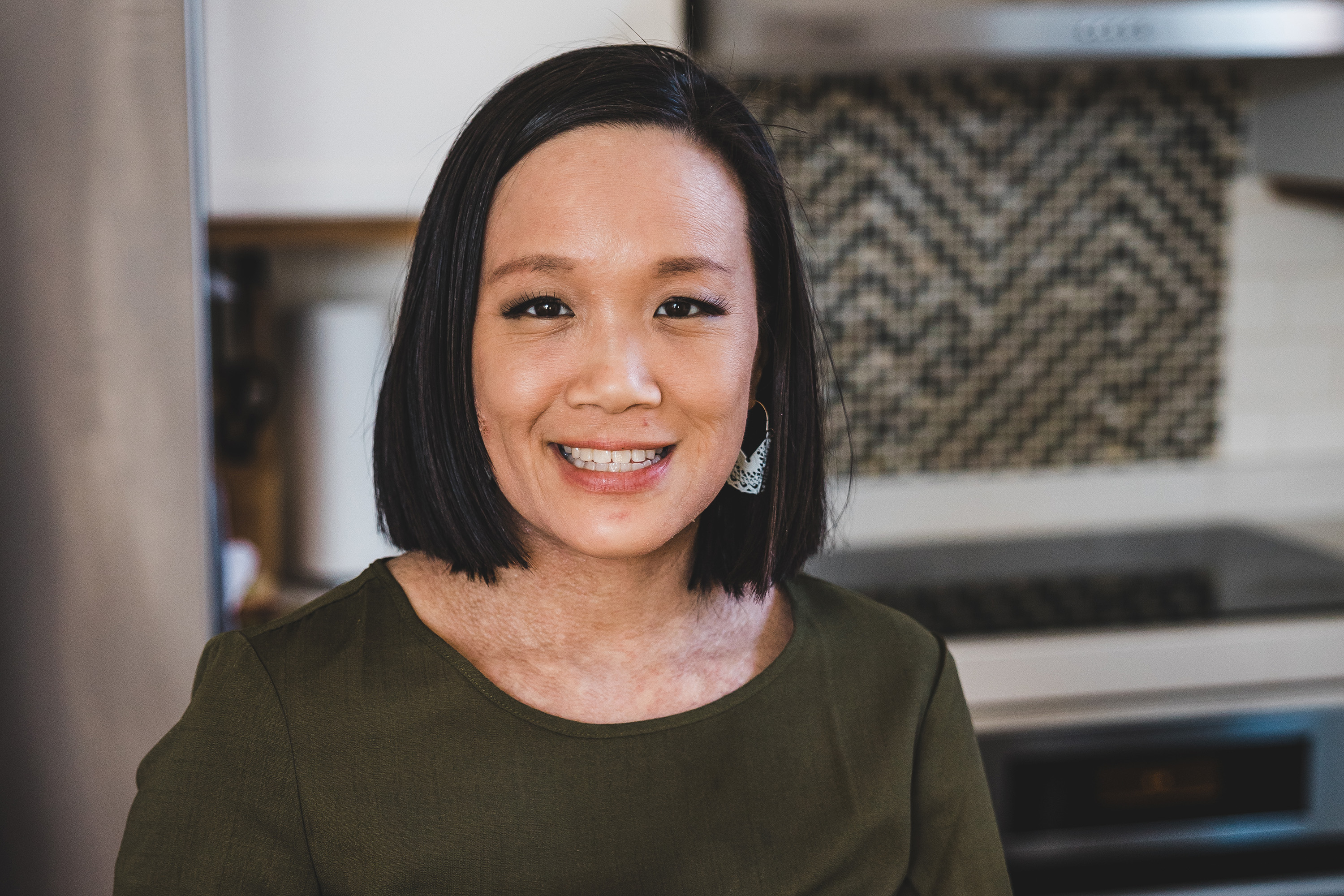 Does Eczema Define Who You Are? Here’s One Take