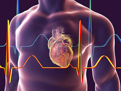 人的心脏，心脏损伤的模型。