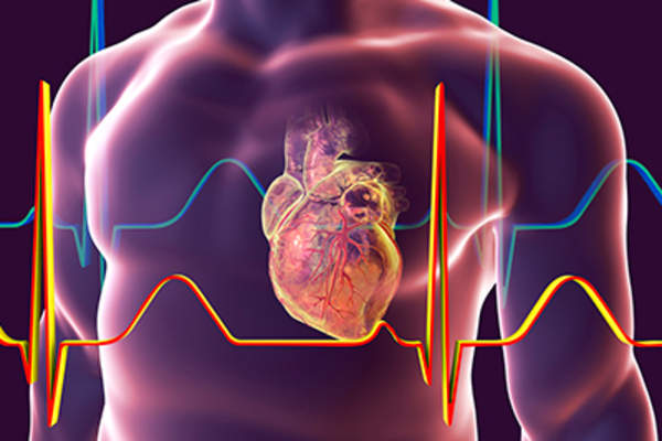 人的心脏,心脏损伤的模型。