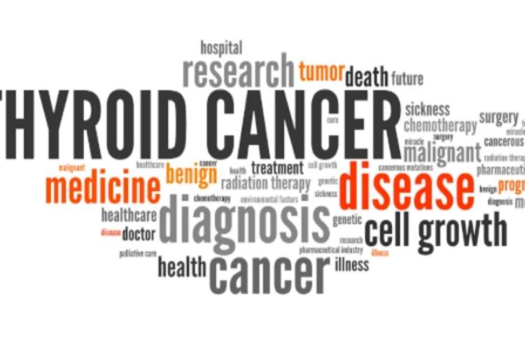甲状腺癌的概念。