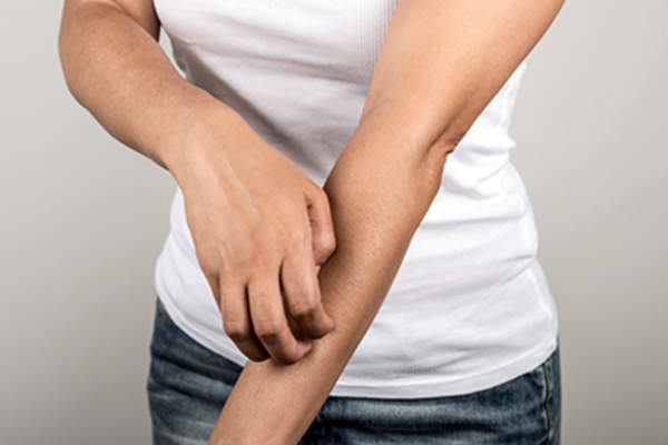 女人瘙痒手臂。