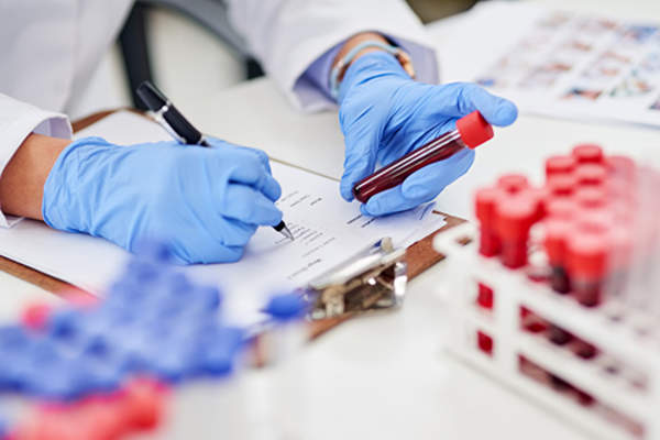 血液测试。