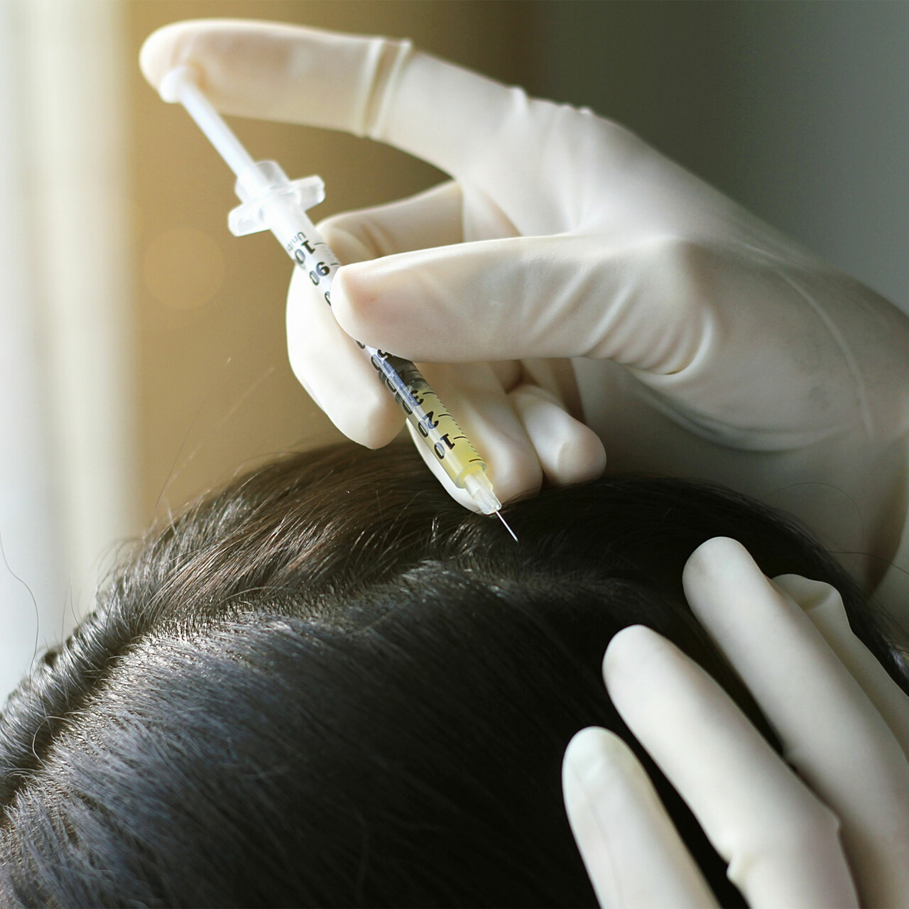 医生给病人的头皮注射