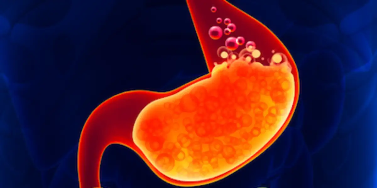 Aquí Que Es Benign Neoplasm Of Stomach popular Aquí Que Es Benign Neoplasm Of Stomach popular