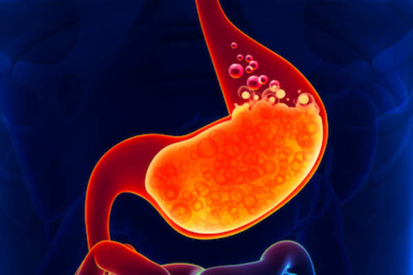 用鼓泡胃酸胃的图像。