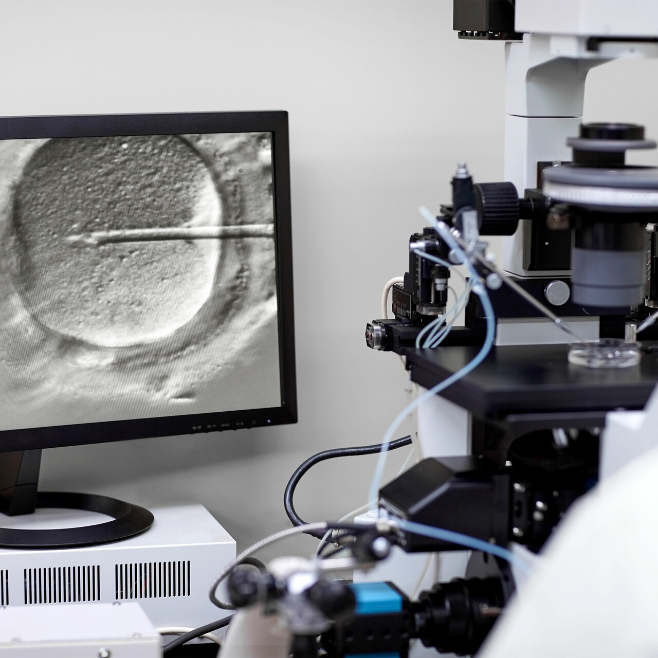 设备和显示受精卵的显示器