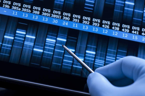 识别DNA序列中的发生变化。