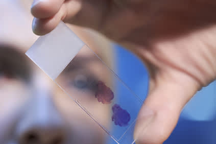 在显微镜载玻片上检查血细胞。