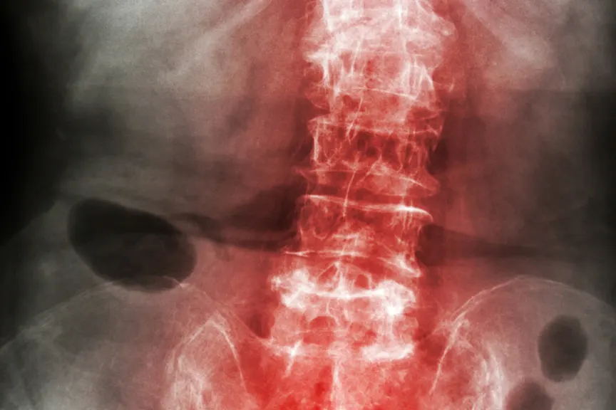 highlighted spine