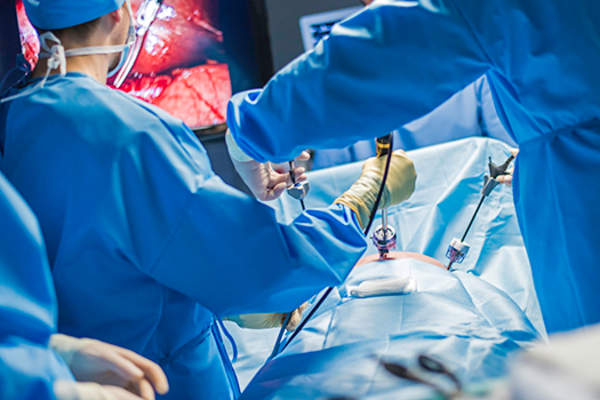 腹腔镜手术。