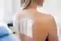 A view of an allergy patch test on a woman’s back