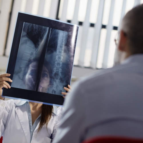 医生看一个病人脊柱的X射线。