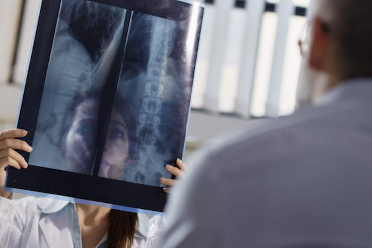 医生对病人的脊椎进行x光检查。