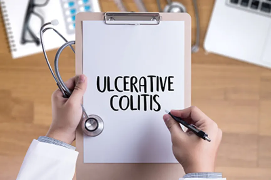 拿着溃疡性结肠炎剪贴板的医生。