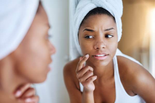 非洲裔美国人的皮肤