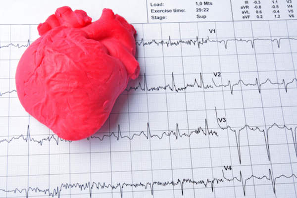 心脏疾病的概念
