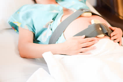 孕妇有心脏监护婴儿。