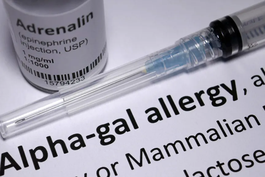 Alpha-gal, red meat allergy.