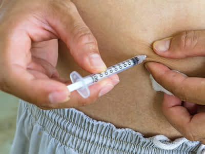 糖尿病患者在胃里注射胰岛素。