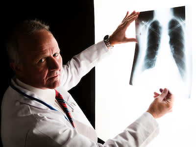 医生正在检查癌变的肺部x光片。