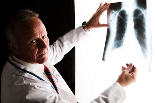 医生正在检查癌变的肺部x光片。