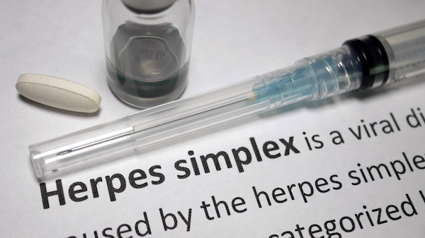 10-ways-to-prevent-herpes-outbreaks-genital-herpes-healthcentral