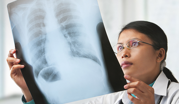 女医生检查X射线