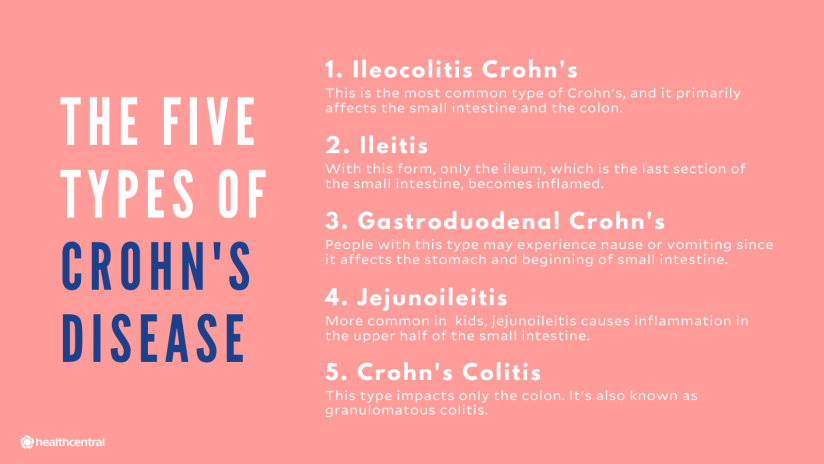 克罗恩病的五种类型，回结肠炎克罗恩病，回肠炎，胃十二指肠克罗恩病，空肠回肠炎，克罗恩结肠炎
