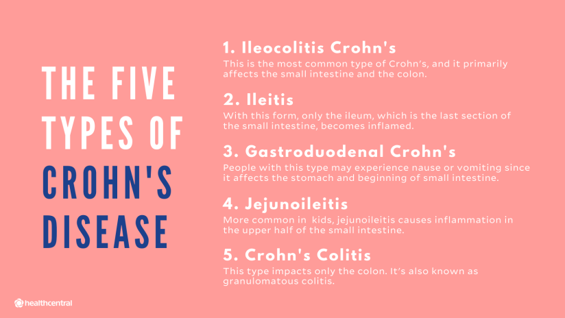 克罗恩病的五种类型，回结肠炎克罗恩病，回肠炎，胃十二指肠克罗恩病，空肠回肠，克罗恩结肠炎
