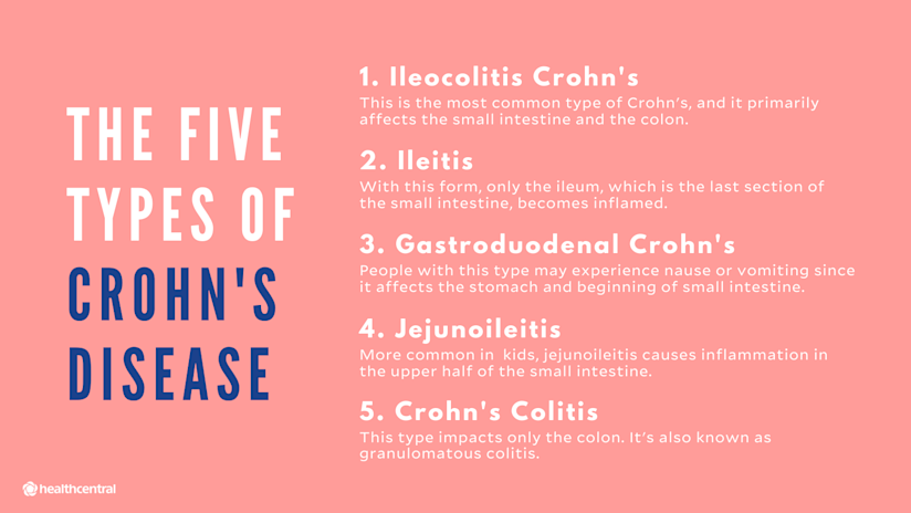 五种类型的克罗恩疾病,eLeocolitycrohn,胃炎,胃炎,胃肠炎,克罗恩炎,克罗恩的结肠炎