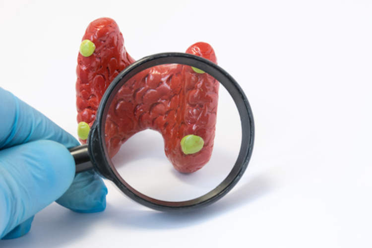 Doctor holding magnifying glass and through it examines model of parathyroid glands, conducting diagnostics for disease.