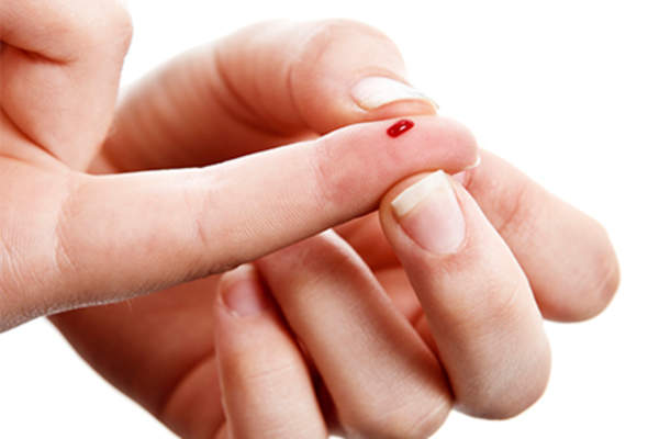 挤血从手指下降。