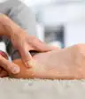 足底筋膜炎