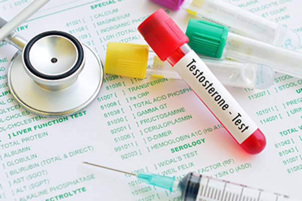 睾酮测试小瓶。