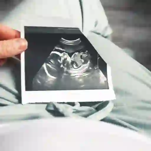 胎儿的超声图像