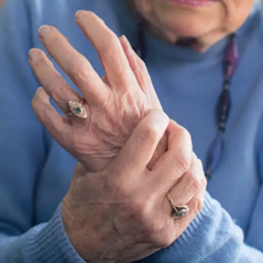 患有风湿性关节炎的妇女在疼痛中抓手。