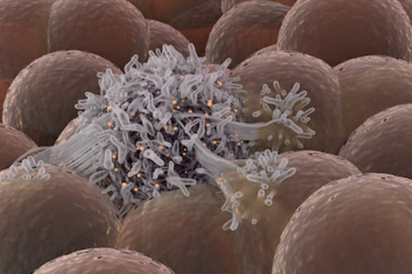 健康细胞中的恶性癌细胞。