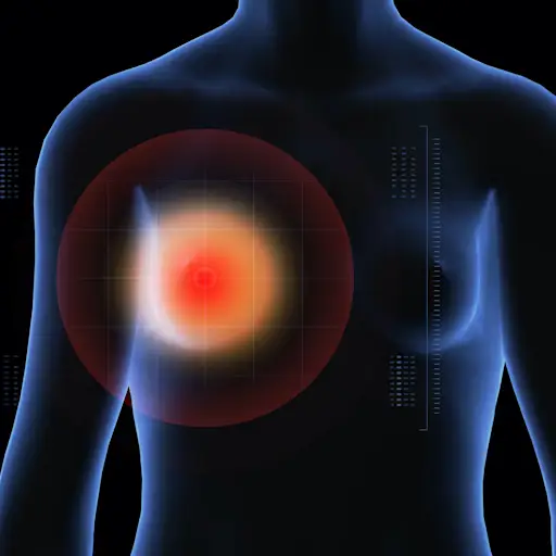 乳腺癌靶向治疗