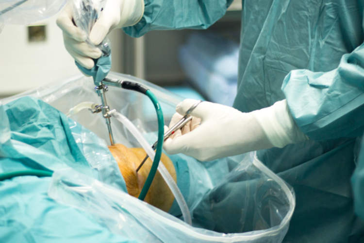 外科医生进行膝关节置换手术。