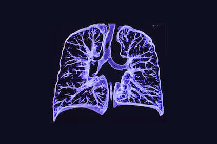 肺CT