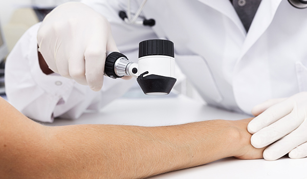 医生检查皮肤癌图像