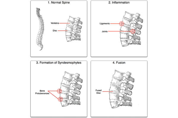 该强直过程中，Senseiwa从格雷的解剖制成，具有脊椎的图像
