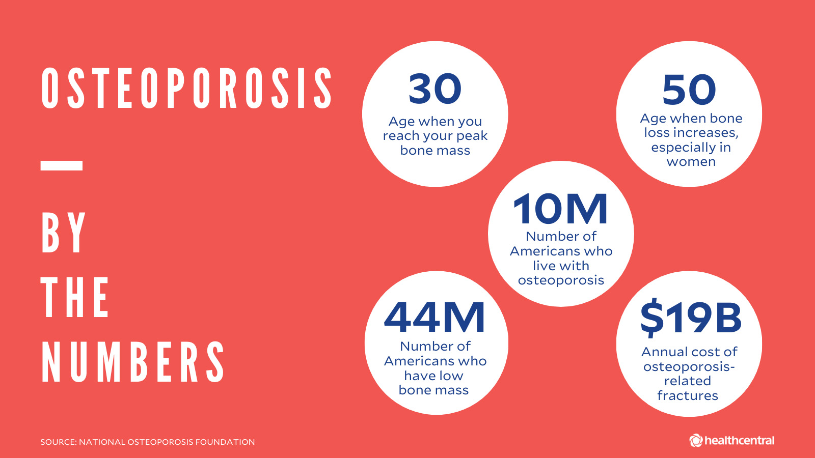 What Every Woman Should Know About Osteoporosis: Associates in